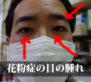 花粉症の目の痒みに使う漢方薬は 東大阪市の福田漢方薬局